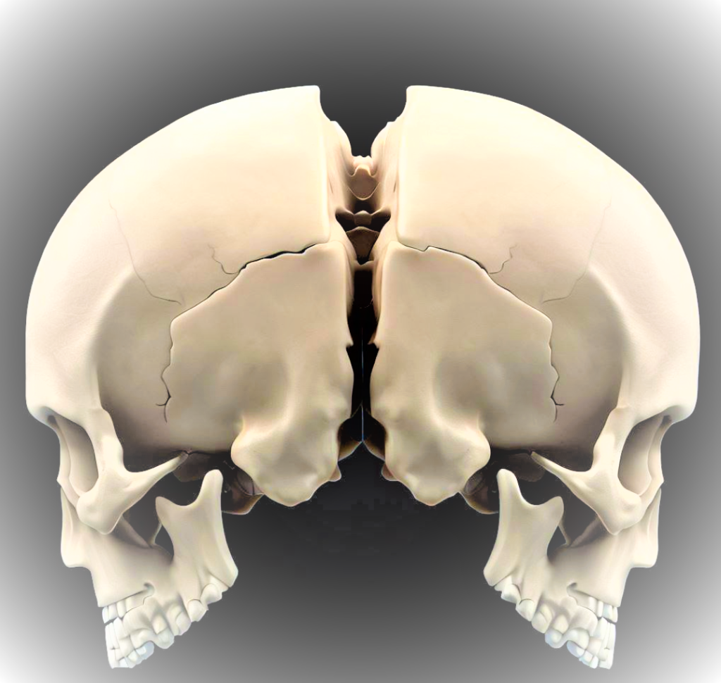 Parietal bone anatomy