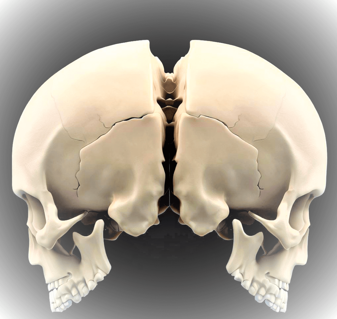 Parietal bone