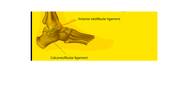 Anterior Talofibular Ligament (ATFL) is a critical ligament located on the lateral (outer) side of the ankle joint.